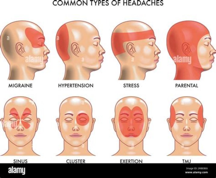 Doctors Discover Man's Headaches Are Caused by Brain Tapeworms—These Foods Are High-Risk