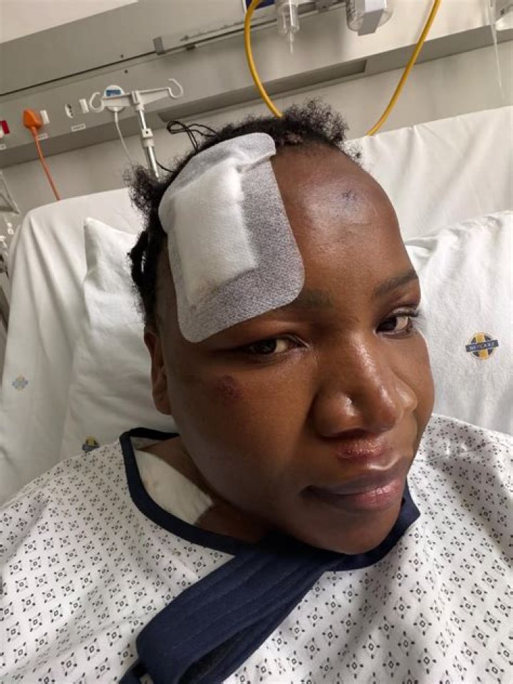 Hayes Grier Hospitalized After Accident – Celeb Secrets