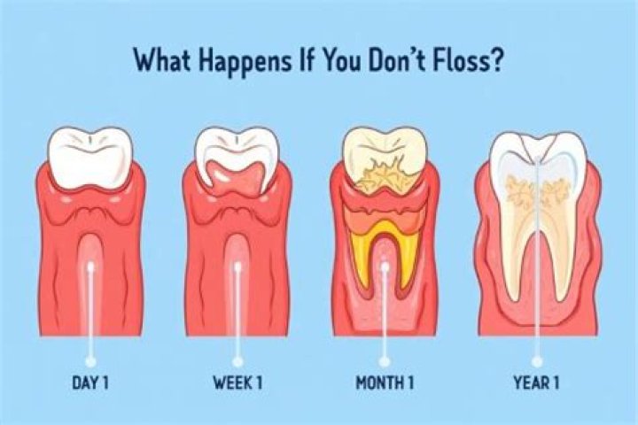 What Happens If You Don't Floss for a Month, According to Dentists